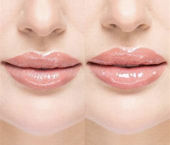 KRX Pocket Filler Lip Plumping Gloss